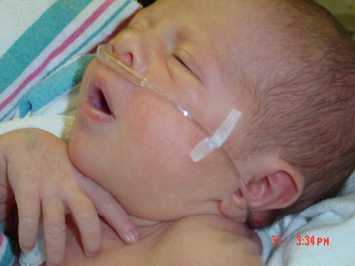 Baby Natalie in the NICU